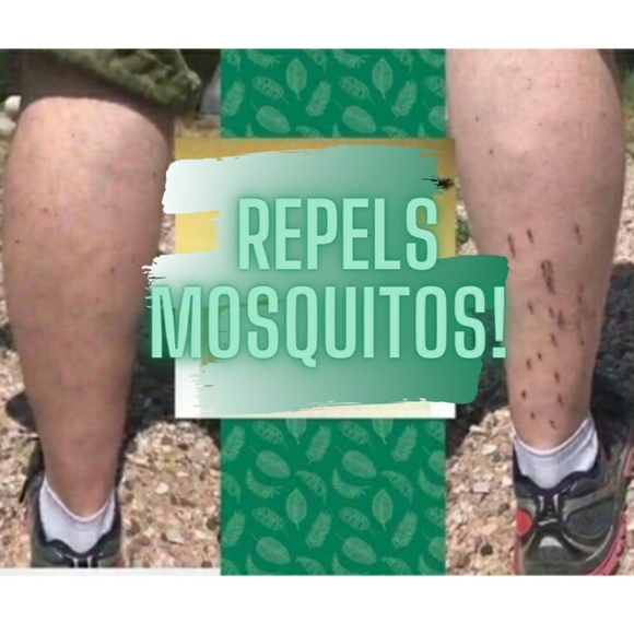 PREORDER ONLY ByeBye Stretch Marks,Mosquitos,Burns - Picture 2 of 16